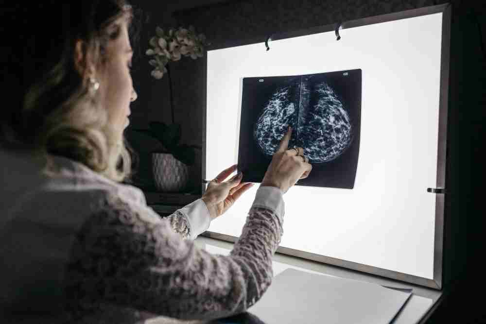 Mammographie présentant une anomalie