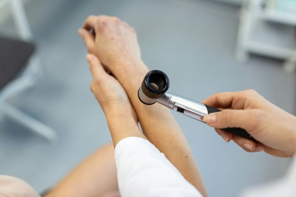 Dermascope pour détecter mélanome de la peau