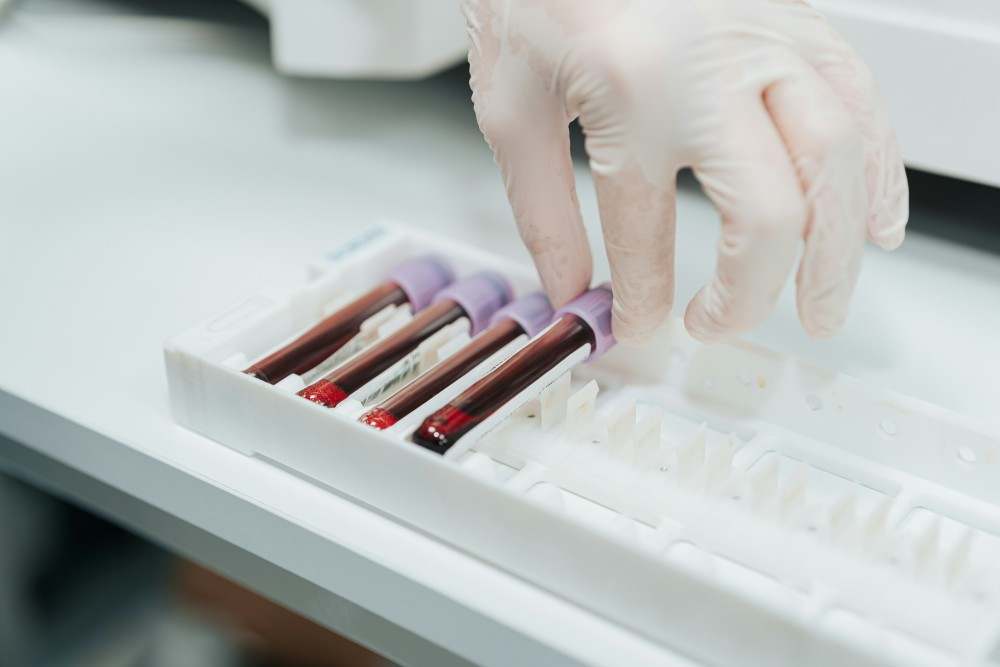 Quel taux de ferritine pour un cancer ?