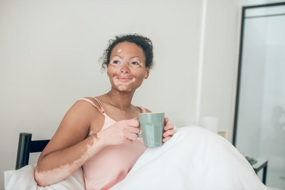 Tache blanche sur la peau vitiligo