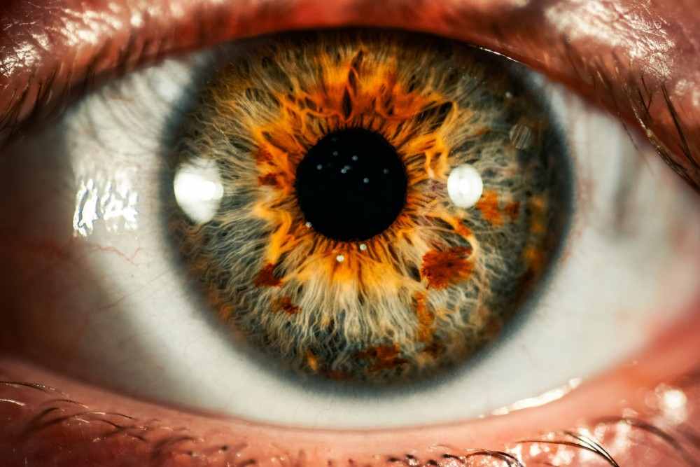 Changer la couleur des yeux kératopigmentation