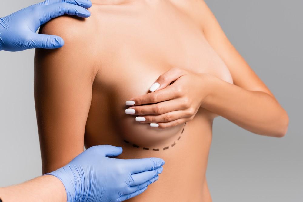 Chirurgie seins Paris