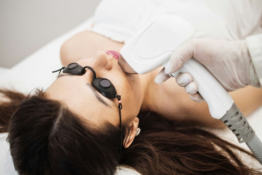 Traitement des rides au laser