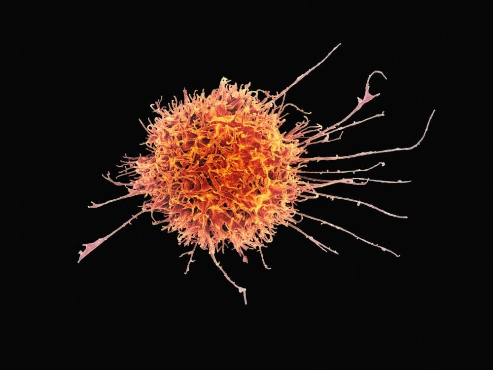 Bactérie transmissible chlamydia