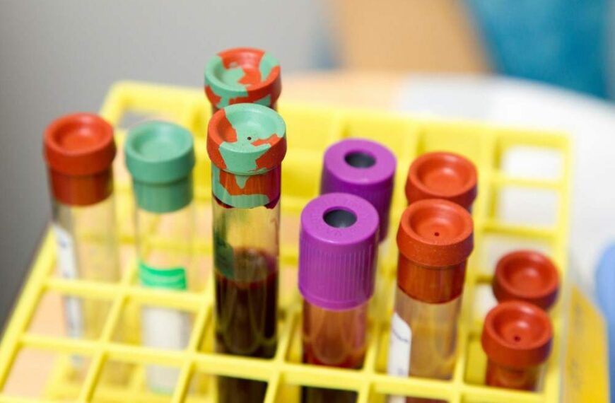 Quel taux d'urée est dangereux, tubes à essai avec du sang