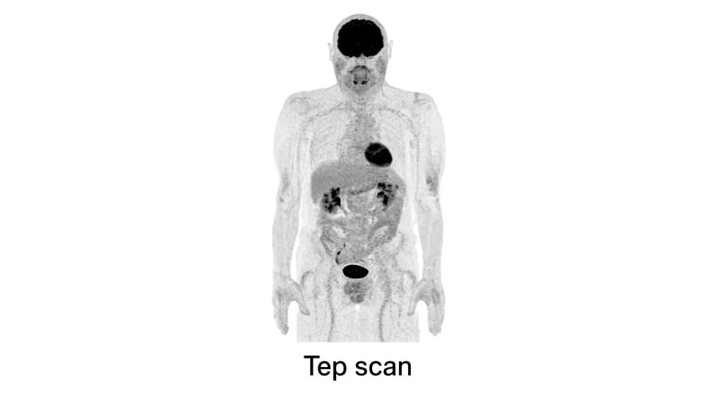 Homme faisant un tep-scan