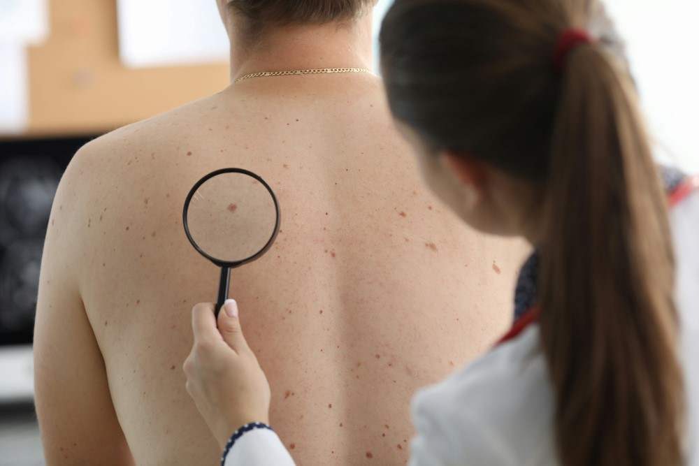 Dermatologue qui examine son patient entièrement carcinome