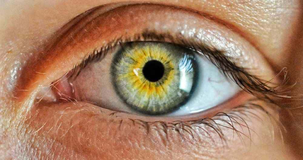 Syndrome de susac yeux