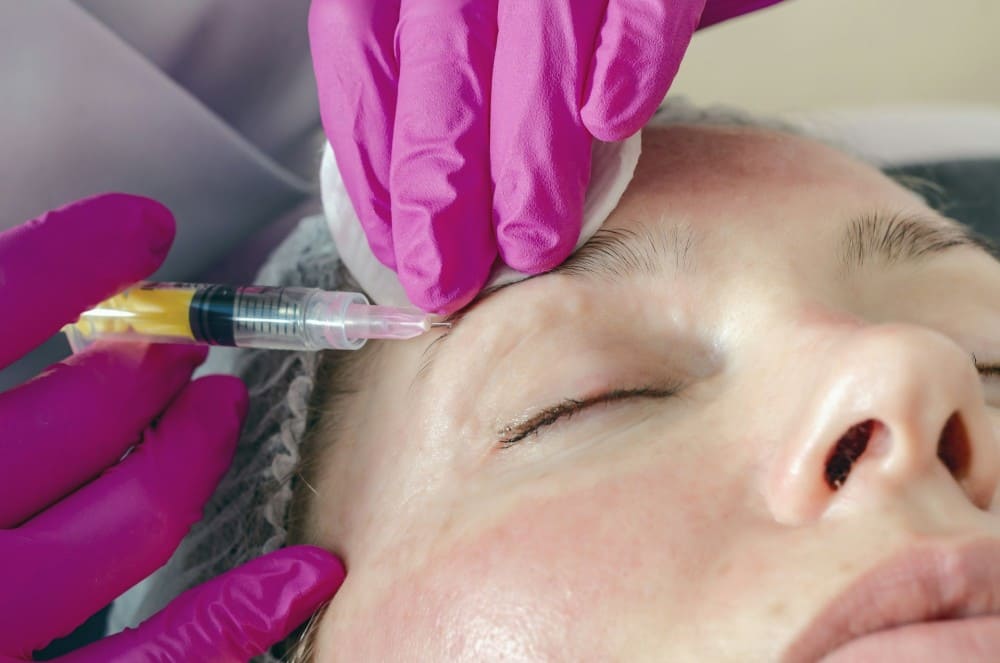 Femme botox au niveau du front