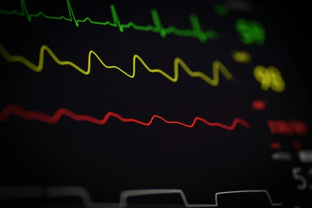 Peut-on mourir avec un défibrillateur implanté ?